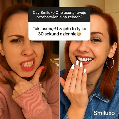 Smiluxo One